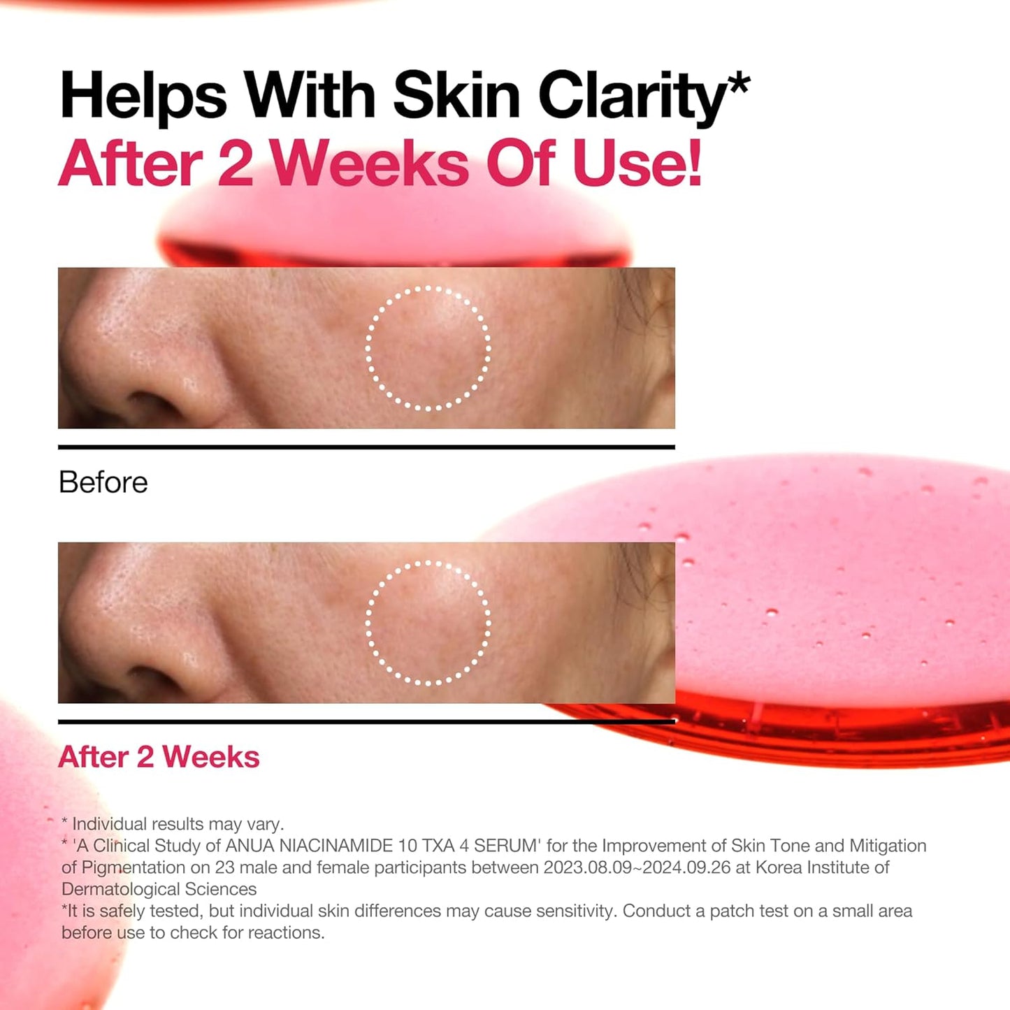 ANUA Niacinamide 10% + TXA 4% Serum 30 ml