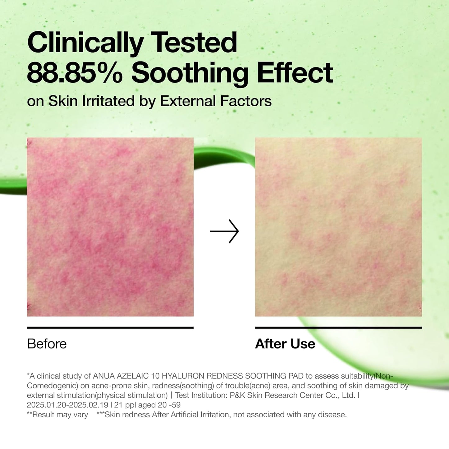 ANUA SOOTHING PAD Azelaic 10 + Hyaluron 90 pads (230ml / 7.77 Fl.oz)